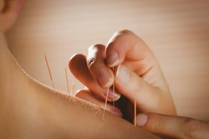 「奥まで刺さるのが怖い…」鍼の深さと体への影響とは”を解説