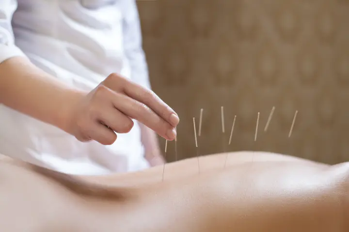 【部位・症状別】鍼を刺す深さの目安を紹介