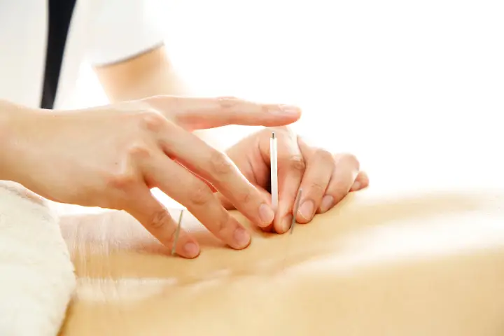 「鍼って効くの？」と疑問の方へ｜仕組みと効果を解説